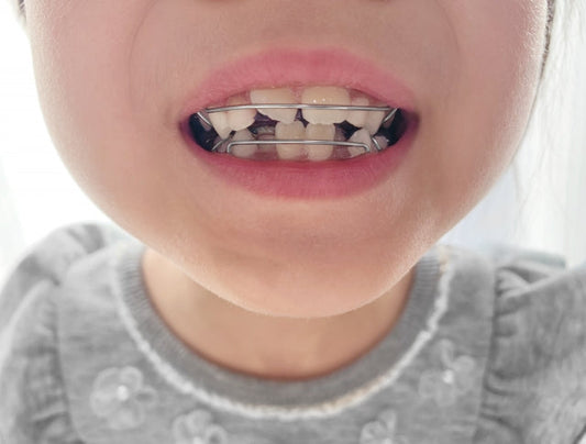 抱っこや寝かせ方と歯並び