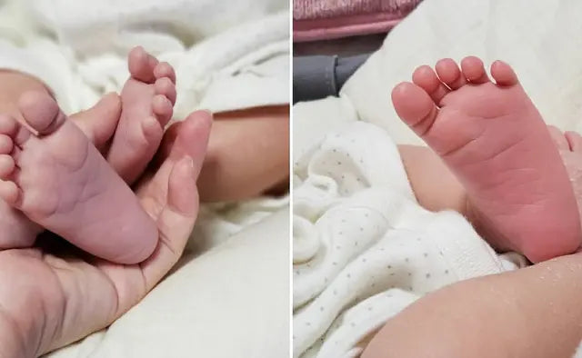 赤ちゃんの手足の冷えと便秘