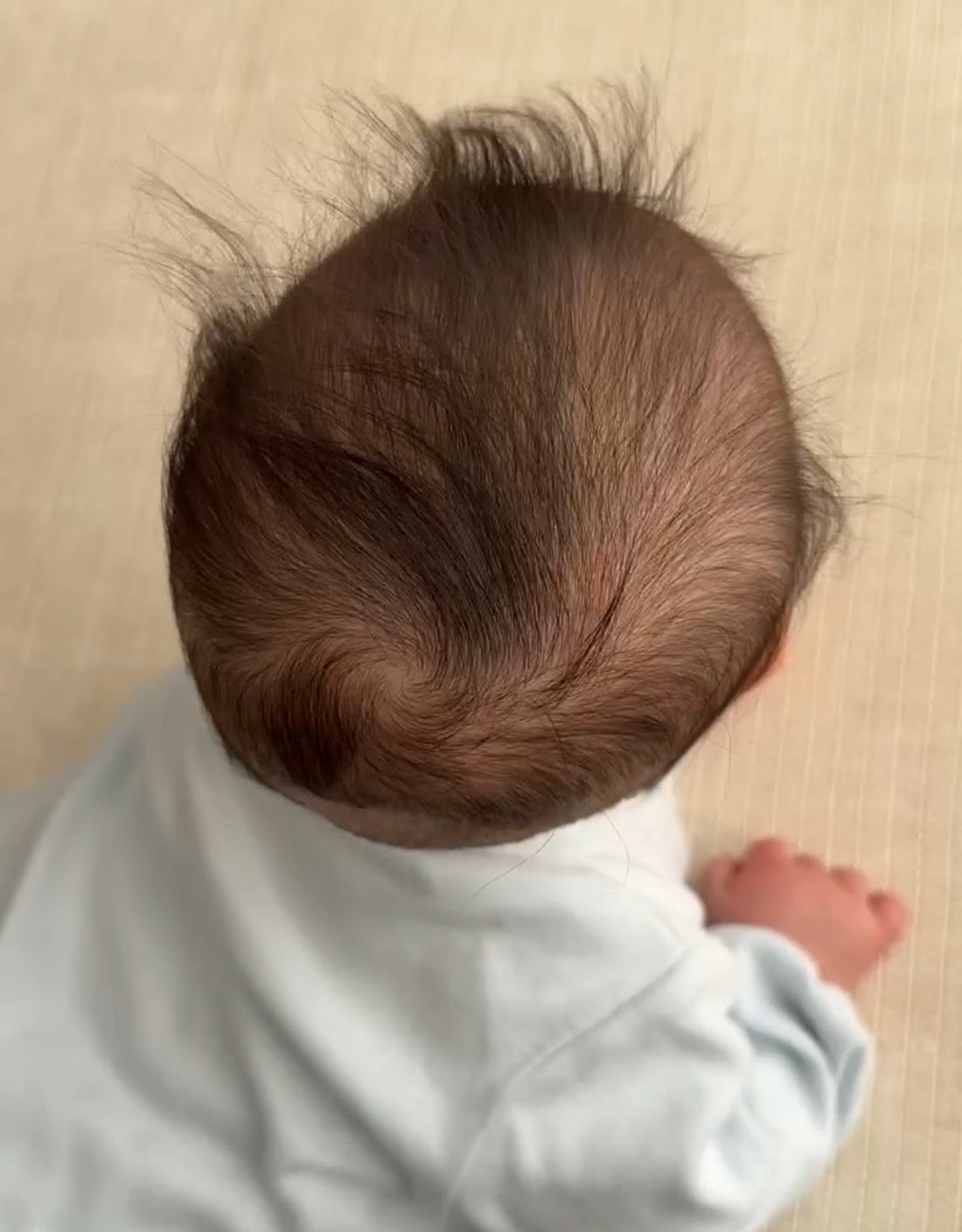 赤ちゃんの向き癖と頭の形、気づいたときに大切な考え方